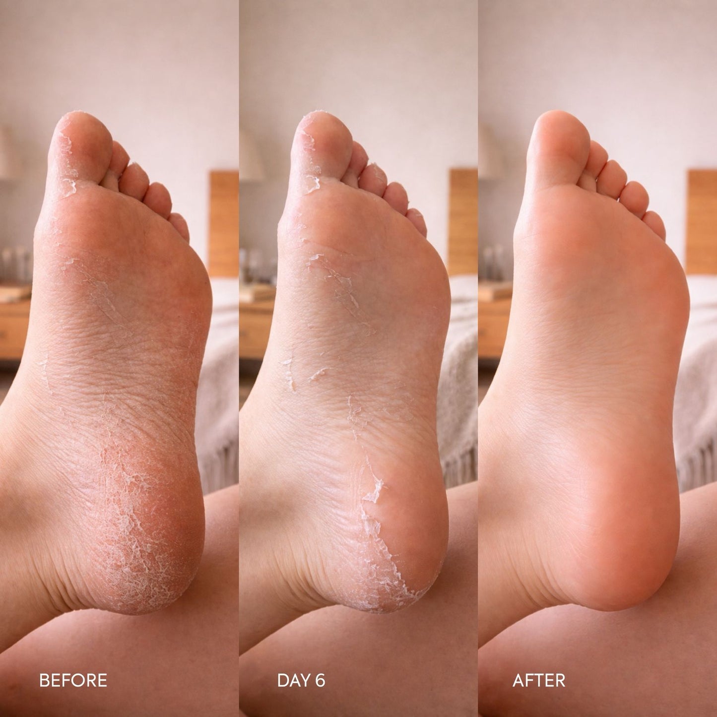 Foot Peeling Socks (Pack of 3)