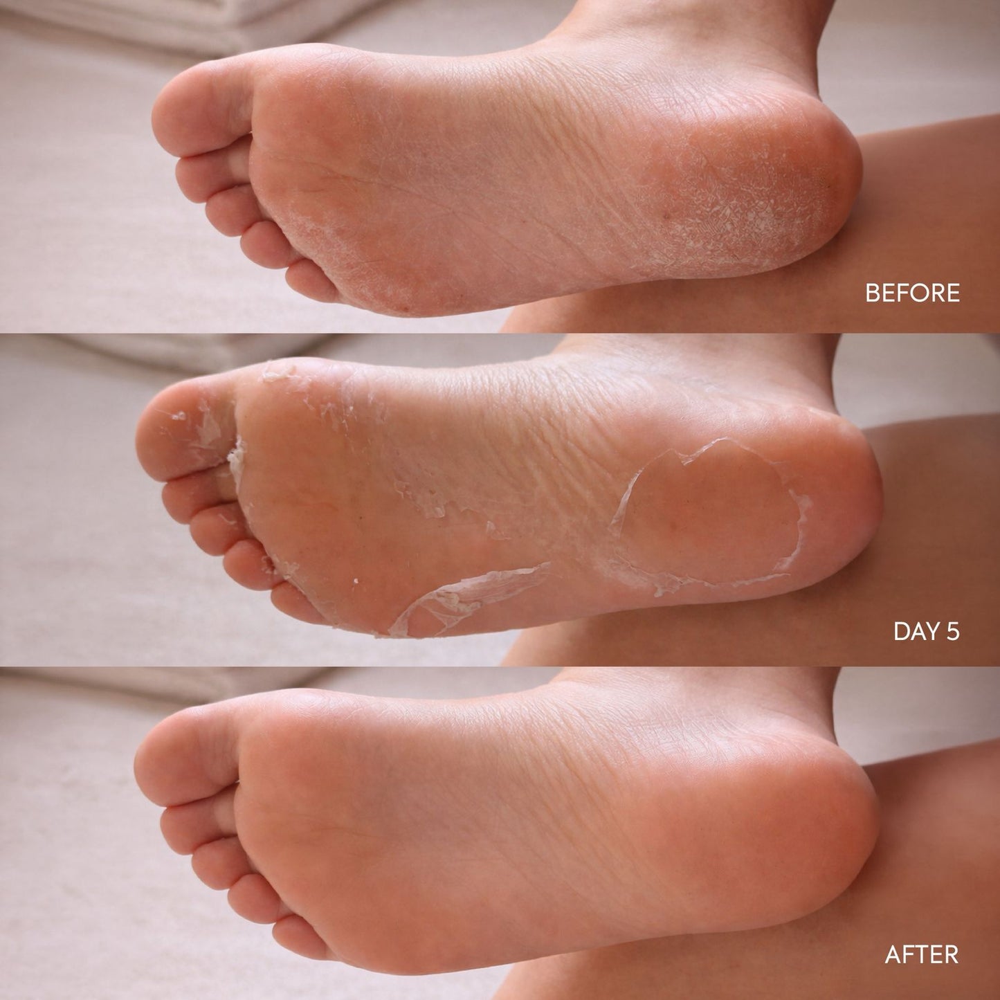 Foot Peeling Socks (Pack of 3)